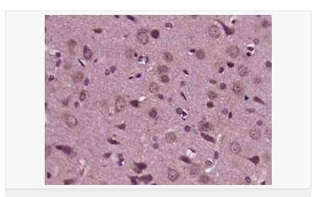 6052ab6b9d69b.png image.png