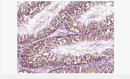 60540f120e688.png image.png