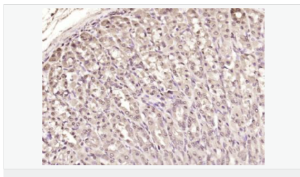 60543fb97ee87.png image.png