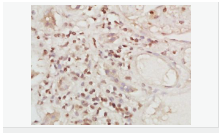 605801e1dc2e2.png image.png