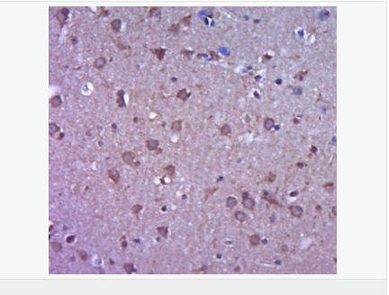 6058060fd5aad.png image.png