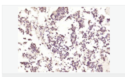 605944ea82b6c.png image.png