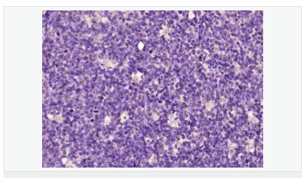 605944f8d87cd.png image.png