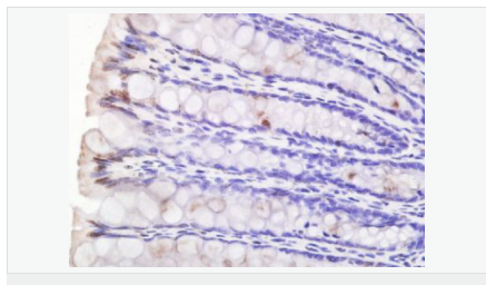 60595d453643e.png image.png