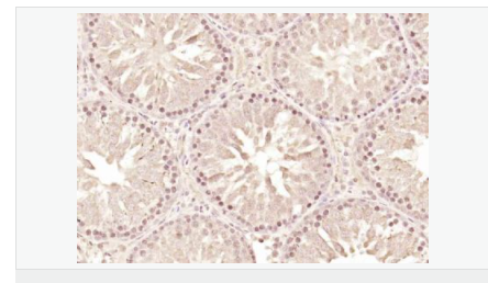 6066b32306572.png image.png