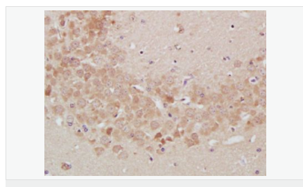 6076477362d81.png image.png