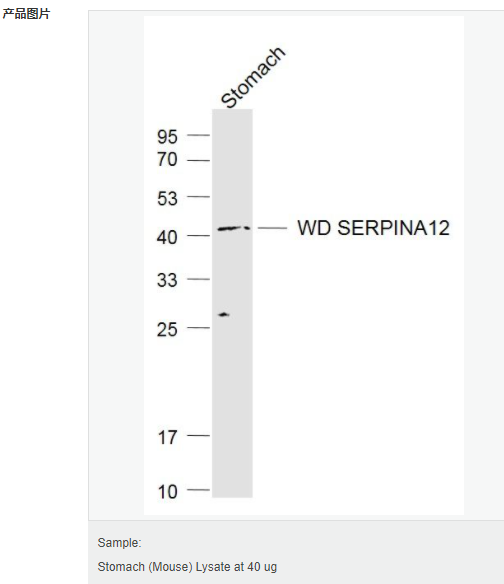 60765c5923769.png image.png