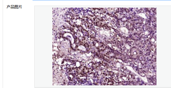 6077952cdfecc.png image.png