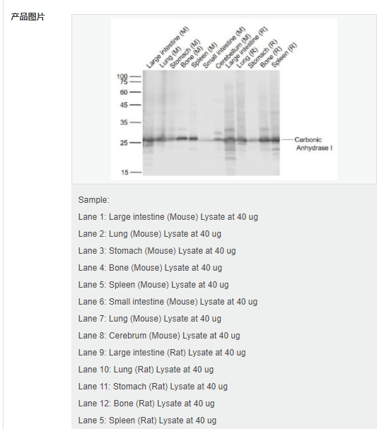 607d3acab90ef.png image.png